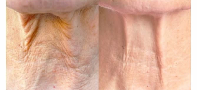 Regala a mamá 10 años menos con Nerium